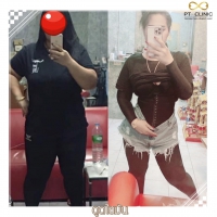 S__131678314.jpg - ดูดไขมัน แผลเล็กมาก เจ็บน้อย ชิวชิว ไม่ต้องวางยา | https://ptinfinity.com