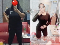 S__131678316.jpg - ดูดไขมัน แผลเล็กมาก เจ็บน้อย ชิวชิว ไม่ต้องวางยา | https://ptinfinity.com