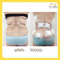 S__131678467.jpg - ดูดไขมัน แผลเล็กมาก เจ็บน้อย ชิวชิว ไม่ต้องวางยา | https://ptinfinity.com