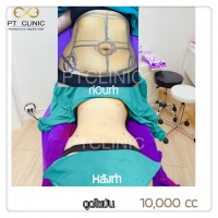 S__131678484.jpg - ดูดไขมัน แผลเล็กมาก เจ็บน้อย ชิวชิว ไม่ต้องวางยา | https://ptinfinity.com