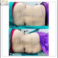 S__147005444.jpg - Review by นันทวรรณ พันอินทรไกวัล | https://ptinfinity.com