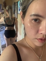 S__146989067.jpg - รีวิวอีกครั้งหลังดูดไขมัน (ทั้งตัวยกเว้นขา) ครบ 2 เดือนครึ่งค่ะ | https://ptinfinity.com