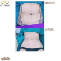 S__146972768.jpg - Review Sandra Young | https://ptinfinity.com