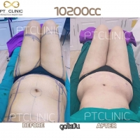 S__146972769.jpg - Review Sandra Young | https://ptinfinity.com