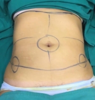 S__146972758.jpg - Review Nalin jamikorn | https://ptinfinity.com