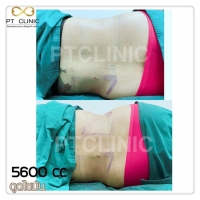 S__146972722.jpg - Review คุณ Aip Lipaup | https://ptinfinity.com