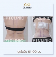 S__146972696.jpg - Review คุณ Ruttanawalee Pakdeesena | https://ptinfinity.com