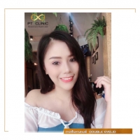 S__109559812.jpg - ตาหางหงส์ ปรับโหวงเฮ้ง ไม่บวม ไม่ช้ำ | https://ptinfinity.com