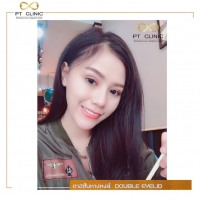 S__109559814.jpg - ตาหางหงส์ ปรับโหวงเฮ้ง ไม่บวม ไม่ช้ำ | https://ptinfinity.com